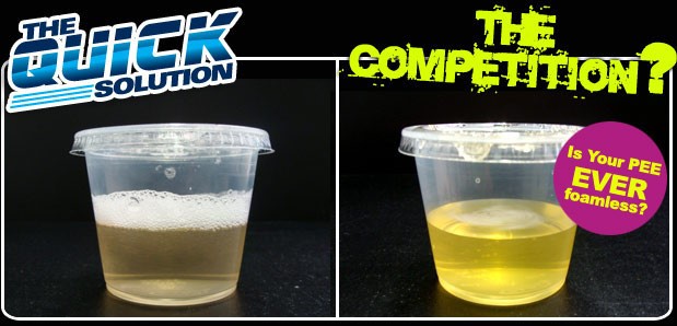 Can Synthetic Urine Be 
      Detected In A Lab Fox Run Vancouver WA